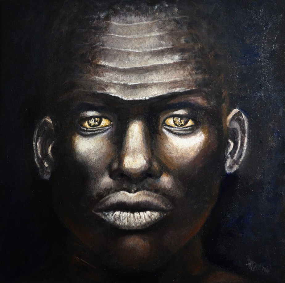 Scars With a Purpose